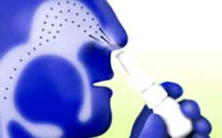 8 спреев для носа, эффективных при лечении гайморита